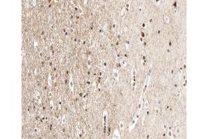 Immunohistochemistry (IHC) image for anti-Ubiquitin A-52 Residue Ribosomal Protein Fusion Product 1 (UBA52) (Internal Region) antibody (ABIN6265860)