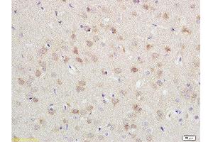 Immunohistochemistry (Paraffin-embedded Sections) (IHC (p)) image for anti-Cadherin 2 (CDH2) (AA 701-800) antibody (ABIN738726)
