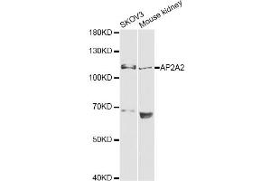 Western blot analysis of extracts of various cell lines, using AP2A2 antibody (ABIN6292468) at 1:1000 dilution. (AP2A2 antibody)