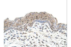 TAPBP antibody was used for immunohistochemistry at a concentration of 4-8 ug/ml. (TAPBP antibody)