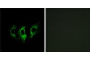 Immunofluorescence analysis of A549 cells, using GFM2 Antibody. (GFM2 antibody  (AA 441-490))