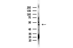anti-Solute Carrier Family 25, Member 46 (SLC25A46) (N-Term) antibody