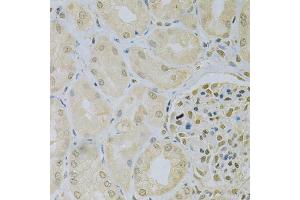 Immunohistochemistry of paraffin-embedded human kidney using CAMK1D Antibody (ABIN5975586) at dilution of 1/100 (40x lens). (CAMK1D antibody)