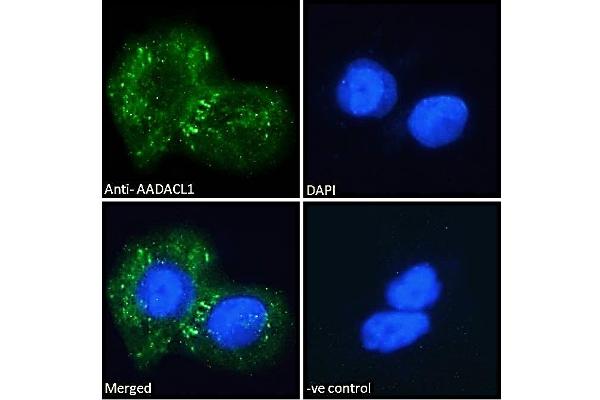 NCEH1 antibody  (C-Term)