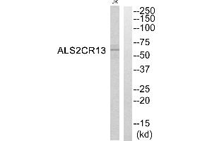 Western blot analysis of extracts from Jurkat cells, using ALS2CR13 antibody. (FAM117B antibody)
