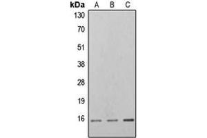 Western blot analysis of 4EBP1 (pT46) expression in K562 PMA-treated (A), NIH3T3 PMA-treated (B), PC12 PMA-treated (C) whole cell lysates. (eIF4EBP1 antibody  (N-Term, pSer46))