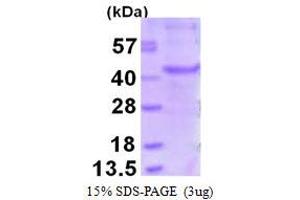 Image no. 1 for Melanoma Antigen Family A, 6 (MAGEA6) protein (His tag) (ABIN1098292) (MAGEA6 Protein (His tag))