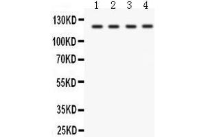 Anti- SLC12A1 Picoband antibody, Western blotting All lanes: Anti SLC12A1  at 0. (SLC12A1 antibody  (N-Term))