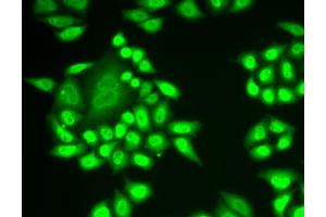 Immunofluorescence analysis of MCF-7 cells using RNF40 antibody. (RNF40 antibody)