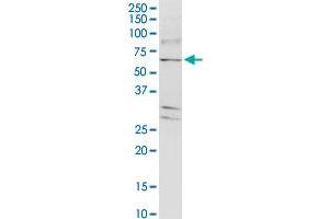TJAP1 monoclonal antibody (M01), clone 2E5. (TJAP1 antibody  (AA 77-180))
