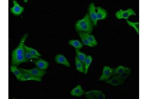 Immunofluorescence staining of HepG2 cells with ABIN7149404 at 1:100, counter-stained with DAPI. (PLA2G4B antibody  (AA 514-781))