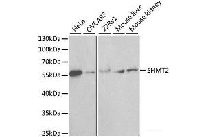 Western blot analysis of extracts of various cell lines using SHMT2 Polyclonal Antibody at dilution of 1:1000. (SHMT2 antibody)