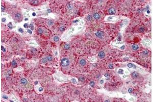 Human Liver: Formalin-Fixed, Paraffin-Embedded (FFPE) (SERPING1 antibody  (AA 1-501))