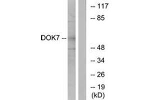 Western blot analysis of extracts from mouse brain cells, using DOK7 Antibody. (DOK7 antibody  (AA 10-59))