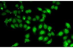 Immunofluorescence analysis of U2OS cells using AFF1 Polyclonal Antibody (AF4 antibody)