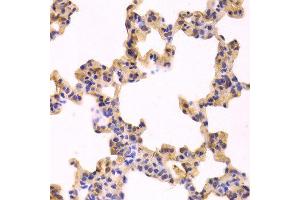 Immunohistochemistry of paraffin-embedded Rat lung using CASP3 antibody at dilution of 1:100 (x400 lens). (Caspase 3 antibody  (AA 100-200))
