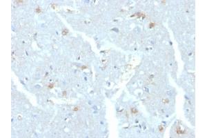 Formalin-fixed, paraffin-embedded human brain stained with UBE2C Mouse Monoclonal Antibody (CPTC-UBE2C-1) (UBE2C antibody)
