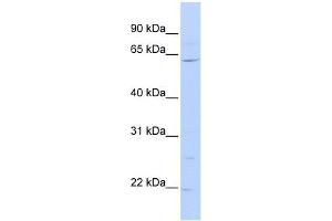 ZNF680 antibody used at 0. (ZNF680 antibody  (N-Term))