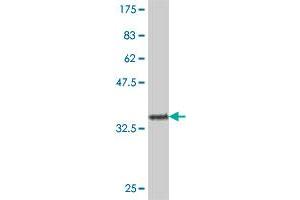 Western Blot detection against Immunogen (37. (MMP1 antibody  (AA 370-469))