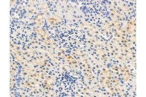 ABIN6263235 and ABIN6278161 at 1/100 staining Rat kidney tissue by IHC-P. (MFN2 antibody  (N-Term))