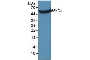 Figure. (Stanniocalcin 1 antibody  (AA 28-247))
