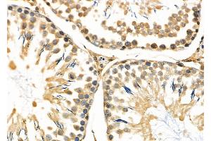 ABIN6263302 and ABIN6266595 at 1/100 staining Rat testis tissue by IHC-P. (Matrix Metallopeptidase 23 (MMP23) (C-Term) antibody)