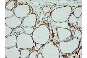 Immunohistochemical staining of paraffin-embedded Human thyroid tissue using anti-XPNPEP1 mouse monoclonal antibody.