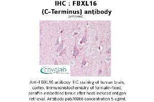 Image no. 1 for anti-F-Box and Leucine-Rich Repeat Protein 16 (FBXL16) antibody (ABIN1734299) (FBXL16 antibody)