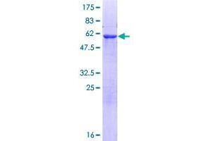 ADPRHL2 Protein (AA 1-363) (GST tag)