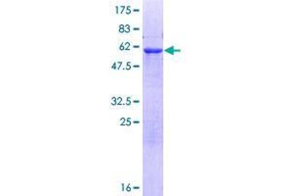 ADPRHL2 Protein (AA 1-363) (GST tag)