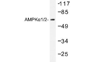 Image no. 1 for anti-Protein Kinase, AMP-Activated, alpha 1 Catalytic Subunit (PRKAA1) antibody (ABIN265305) (PRKAA1 antibody)