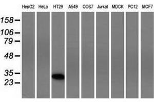 Western blot analysis of extracts (35 µg) from 9 different cell lines by using anti-FHL1 monoclonal antibody.