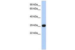 Image no. 1 for anti-Fructosamine 3 Kinase Related Protein (FN3KRP) (N-Term) antibody (ABIN6741474)