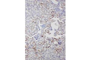 Immunohistochemistry (IHC) image for anti-Amyloid P Component, Serum (APCS) (AA 21-224) antibody (ABIN3042514)