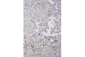 Anti-Serum Amyloid P Picoband antibody, IHC(P): Mouse Kidney Tissue (APCS antibody  (AA 21-224))