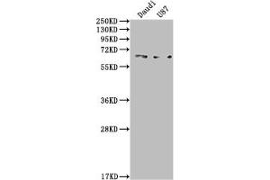 Western Blot Positive WB detected in: Daudi whole cell lysate, U87 whole cell lysate All lanes: ACVRL1 antibody at 1:2000 Secondary Goat polyclonal to rabbit IgG at 1/50000 dilution Predicted band size: 57 kDa Observed band size: 65 kDa (Recombinant ACVRL1 antibody)