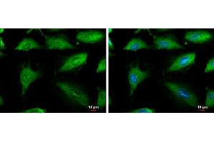 ICC/IF Image Aconitase 1 antibody [N1C1] detects Aconitase 1 protein at cytoplasm by immunofluorescent analysis. (Aconitase 1 antibody)