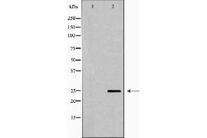 Western blot analysis of Mouse brain lysate, using PRDX6 Antibody. (Peroxiredoxin 6 antibody  (Internal Region))