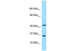 WB Suggested Anti-CRYGN Antibody Titration: 1.