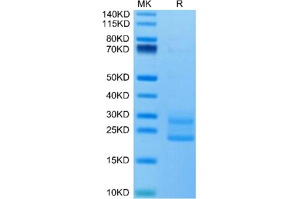 IL-17A/F Protein (AA 26-158) (His-Avi Tag)