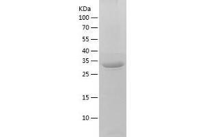 Western Blotting (WB) image for TatD DNase Domain Containing 1 (TATDN1) (AA 1-297) protein (His tag) (ABIN7287654) (TATDN1 Protein (AA 1-297) (His tag))