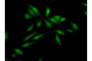 Immunofluorescence staining of Hela Cells with ABIN7127812 at 1:50, counter-stained with DAPI. (Recombinant SKP2 antibody)