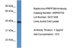 WB Suggested Anti-PRPF38A  Antibody Titration: 0. (PRPF38A antibody  (C-Term))