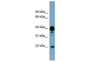 anti-Family with Sequence Similarity 45, Member B (Pseudogene) (FAM45B) (Middle Region) antibody