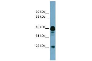WB Suggested Anti-FAM45B Antibody Titration: 0.