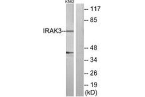 Western blot analysis of extracts from K562 cells, using IRAK3 Antibody. (IRAK3 antibody  (AA 491-540))