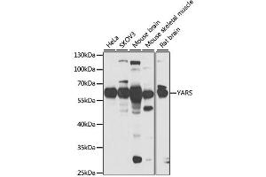 Western blot analysis of extracts of various cell lines, using YARS antibody (ABIN2560805) at 1:1000 dilution. (YARS antibody)