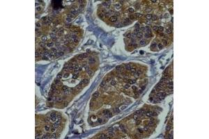 Immunohistochemistry (IHC) image for anti-RAB27B, Member RAS Oncogene Family (RAB27B) (C-Term) antibody (ABIN1440055) (RAB27B antibody  (C-Term))