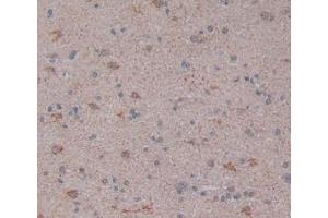 Figure. (LPCAT3 antibody  (AA 122-233))