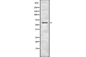 Western blot analysis of Phospho-OSR1 (Thr185) using K562 whole cell lysates (OXSR1 antibody  (pThr185))